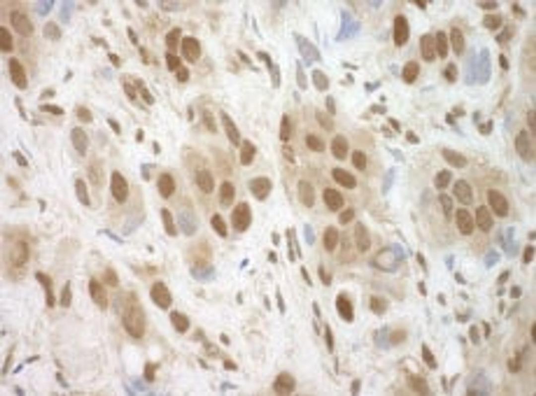 Detection of human BRCC36 by immunohistochemistry.