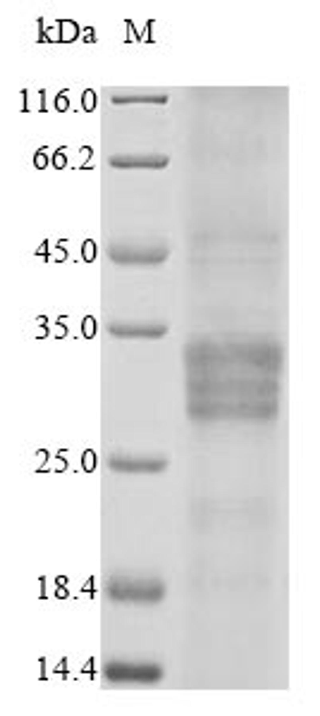 (Tris-Glycine gel) Discontinuous SDS-PAGE (reduced) with 5% enrichment gel and 15% separation gel.