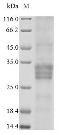 (Tris-Glycine gel) Discontinuous SDS-PAGE (reduced) with 5% enrichment gel and 15% separation gel.