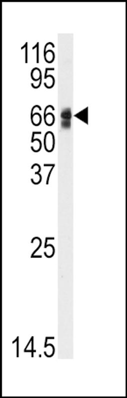 Western blot analysis of anti-AGT Antibody in HepG2 cell line lysates (35ug/lane)