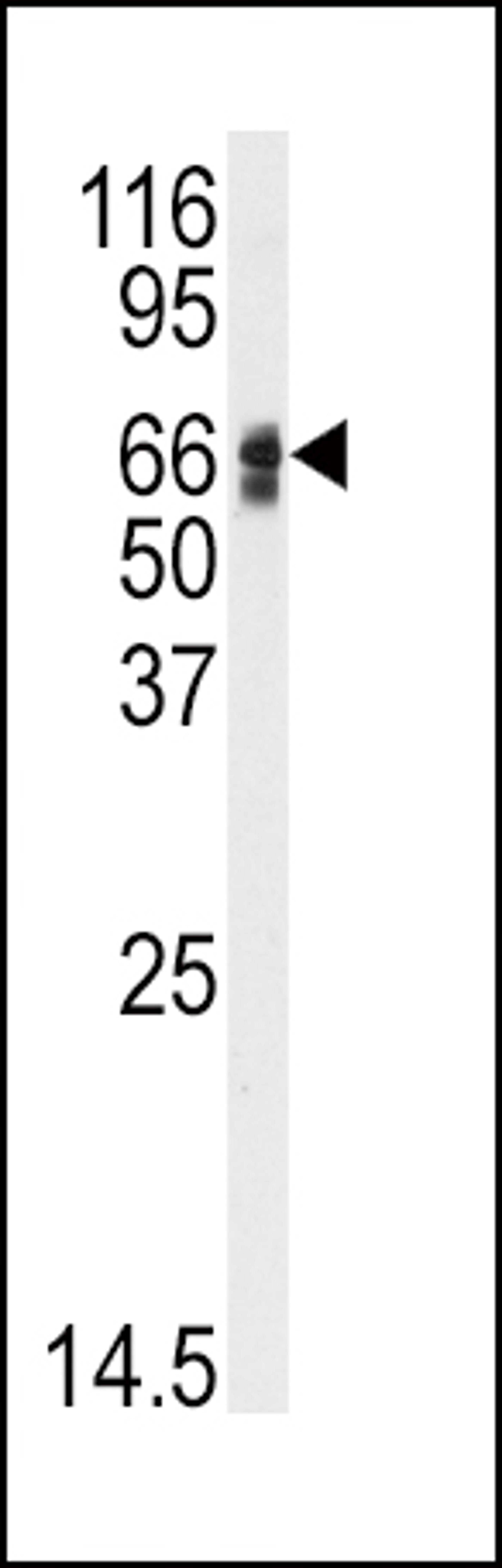 Western blot analysis of anti-AGT Antibody in HepG2 cell line lysates (35ug/lane)