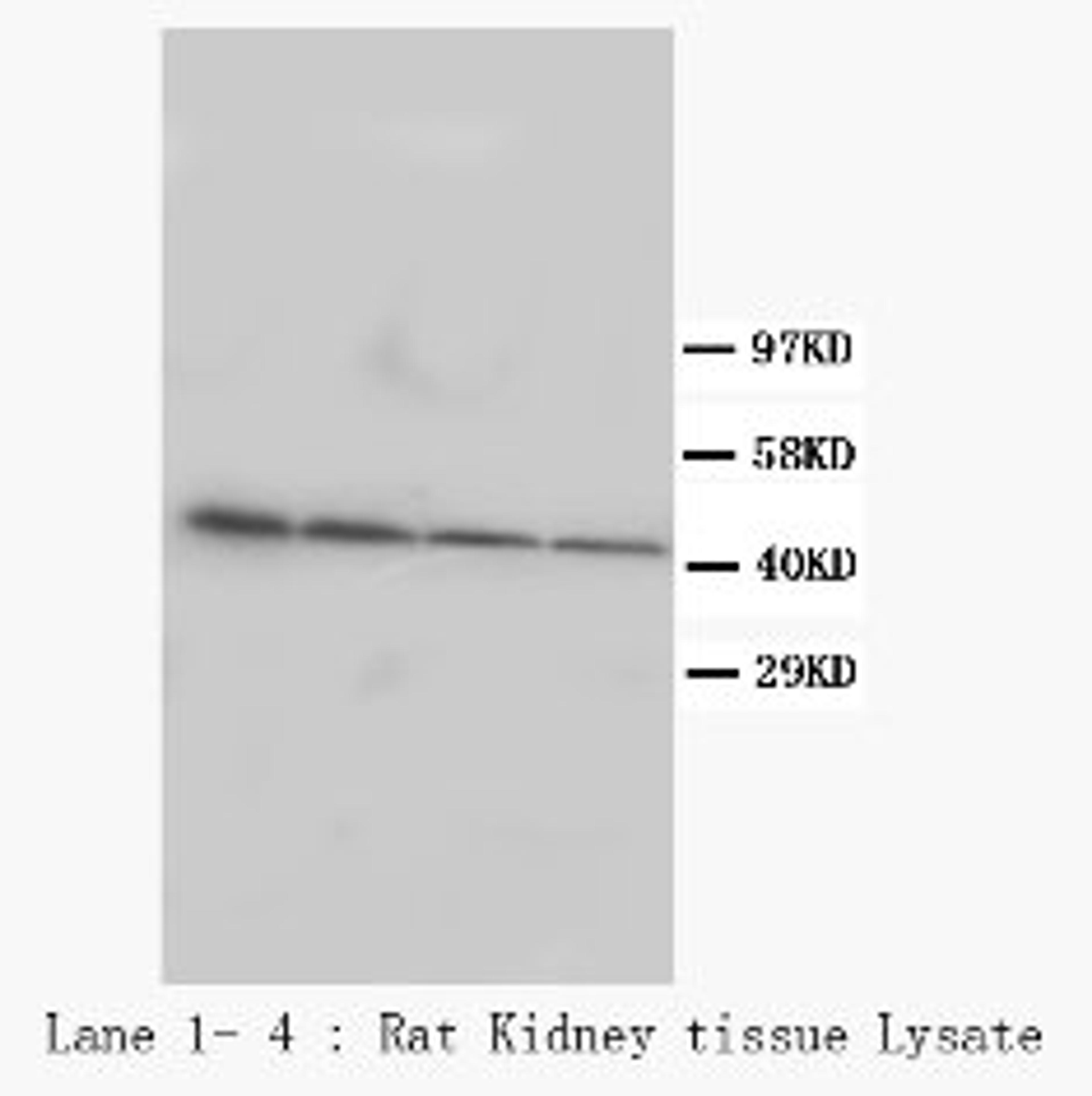 Western Blot analysis of rat kidney tissue lysate using Podocin antibody