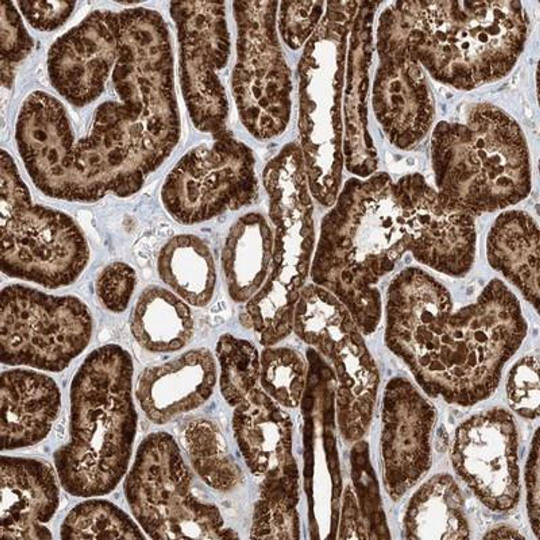 Immunohistochemistry-Paraffin: LCoR Antibody [NBP1-83477] - Staining of human kidney shows strong cytoplasmic positivity in cells of tubules.