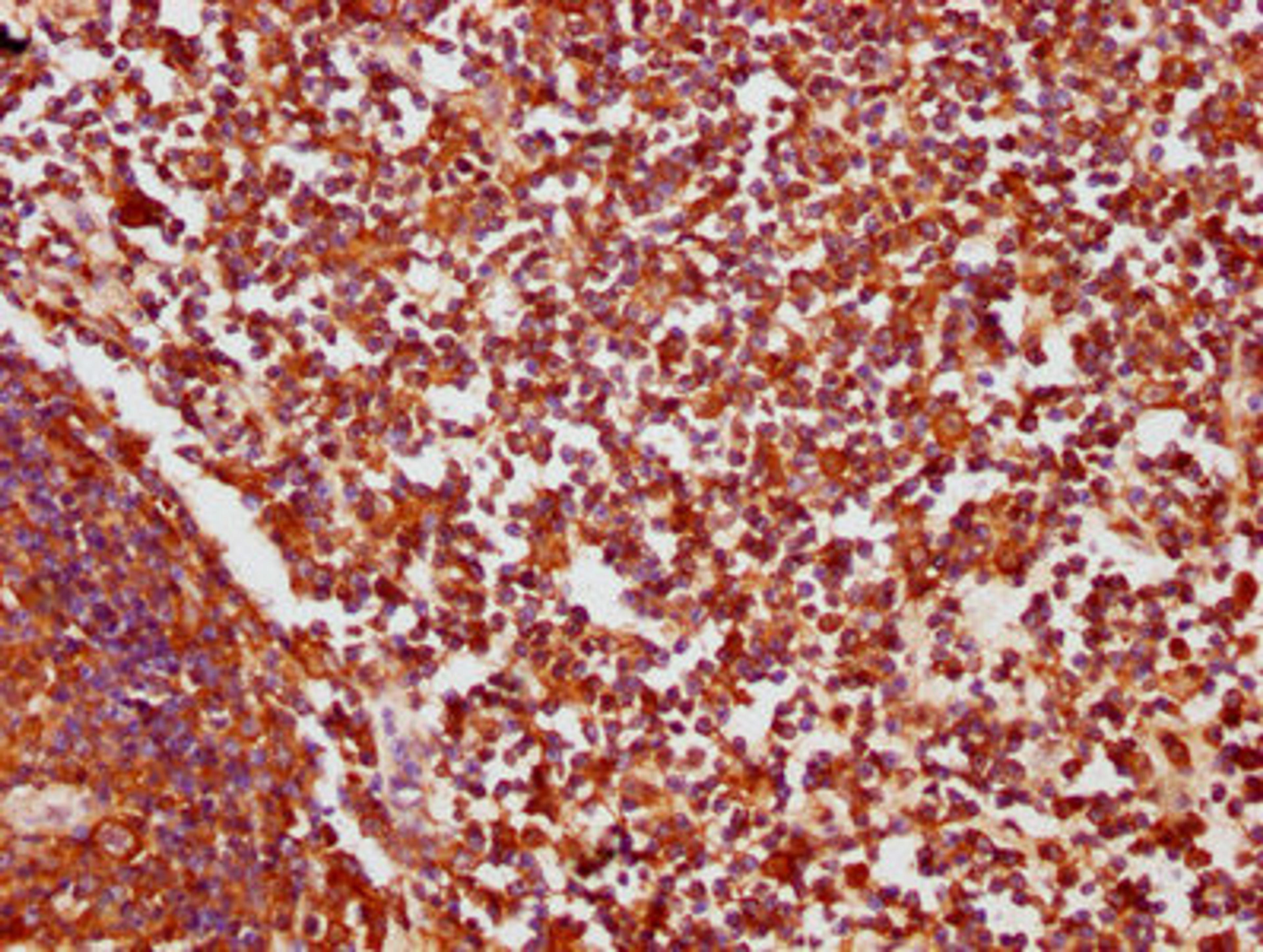 IHC image of CSB-PA005934LA01HU diluted at 1:200 and staining in paraffin-embedded human lymph node tissue performed on a Leica BondTM system. After dewaxing and hydration, antigen retrieval was mediated by high pressure in a citrate buffer (pH 6.0). Section was blocked with 10% normal goat serum 30min at RT. Then primary antibody (1% BSA) was incubated at 4°C overnight. The primary is detected by a biotinylated secondary antibody and visualized using an HRP conjugated SP system.