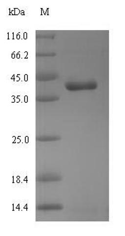 (Tris-Glycine gel) Discontinuous SDS-PAGE (reduced) with 5% enrichment gel and 15% separation gel.