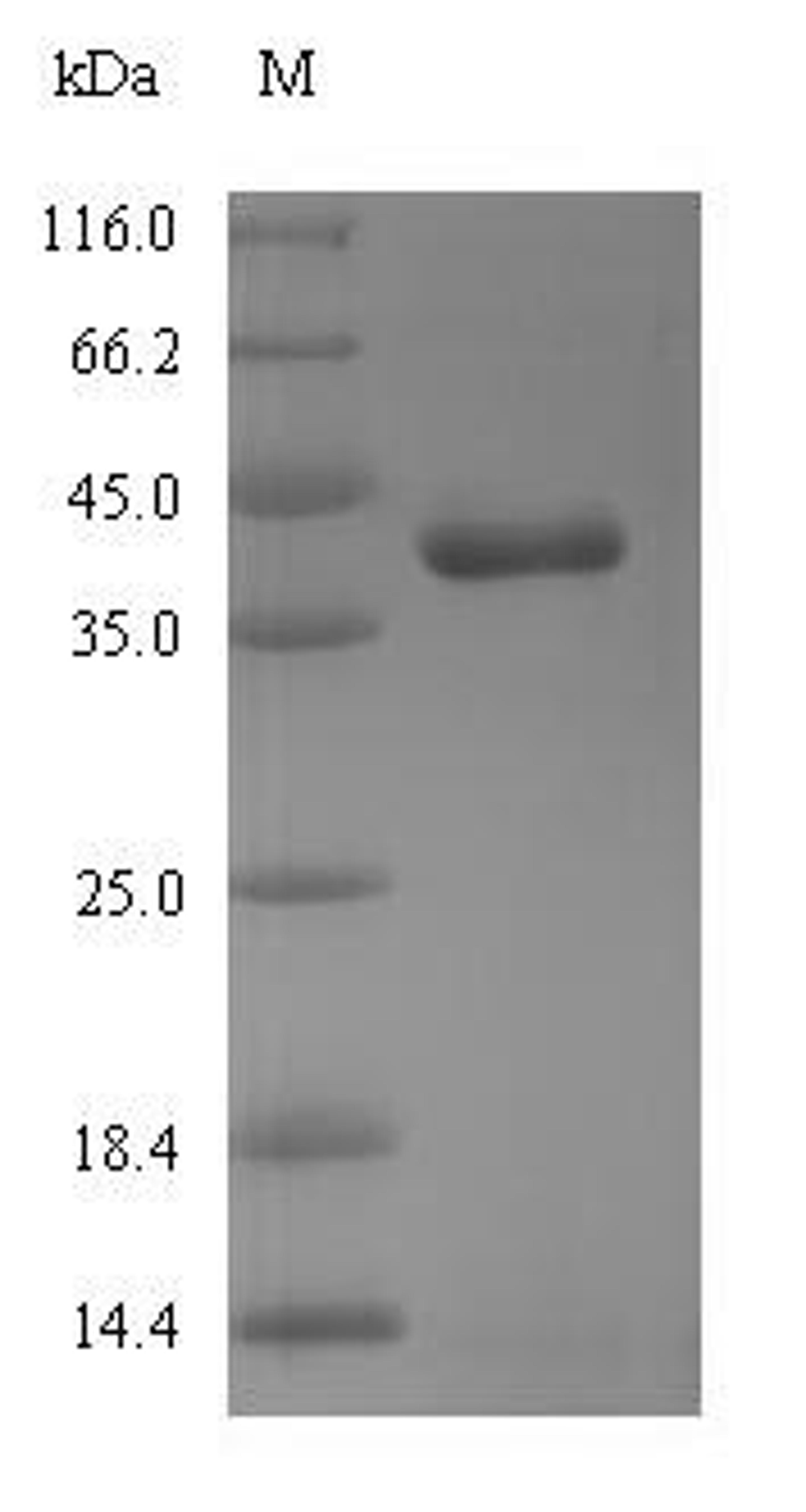 (Tris-Glycine gel) Discontinuous SDS-PAGE (reduced) with 5% enrichment gel and 15% separation gel.