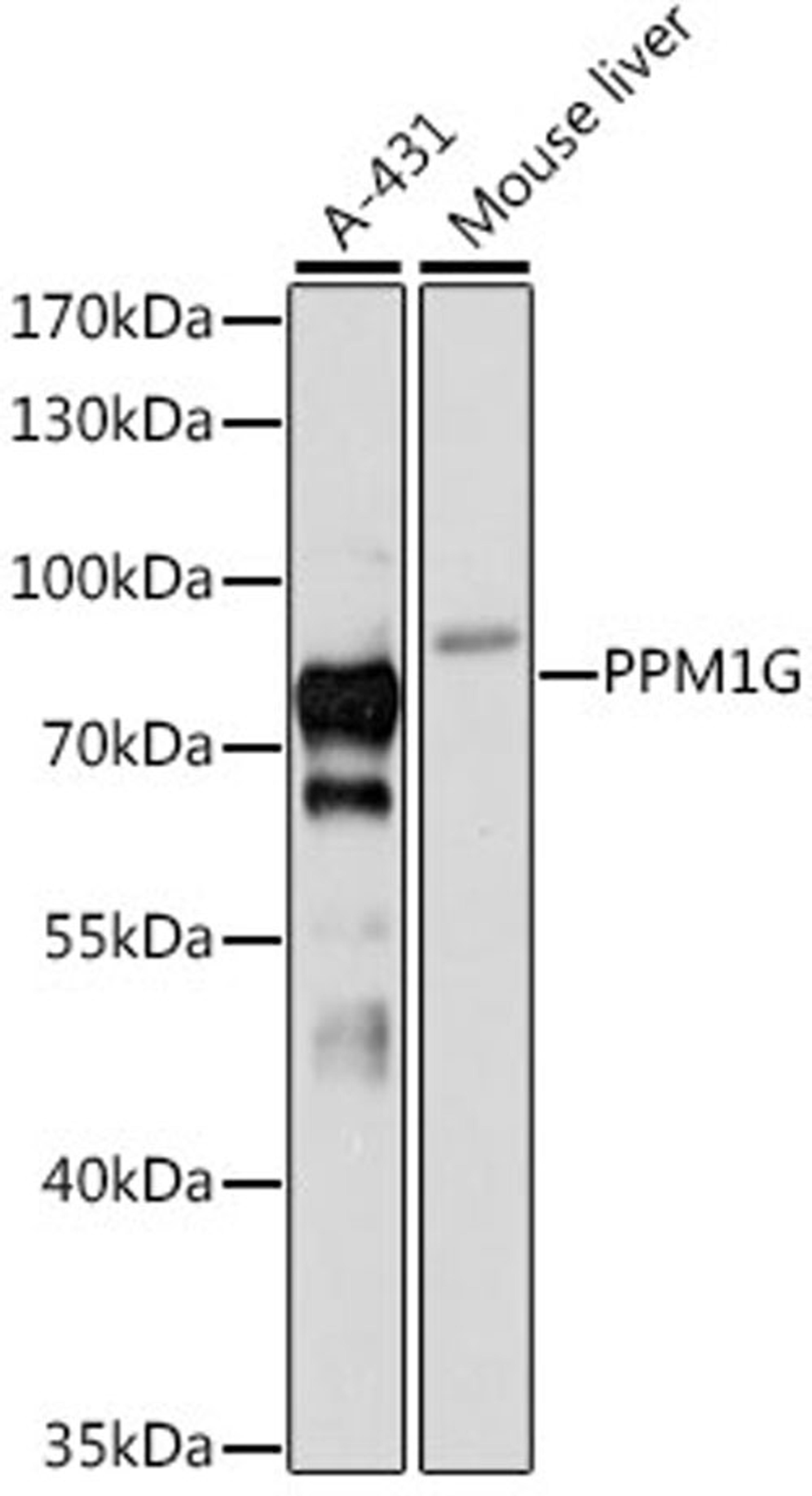 Western blot - PPM1G antibody (A12173)