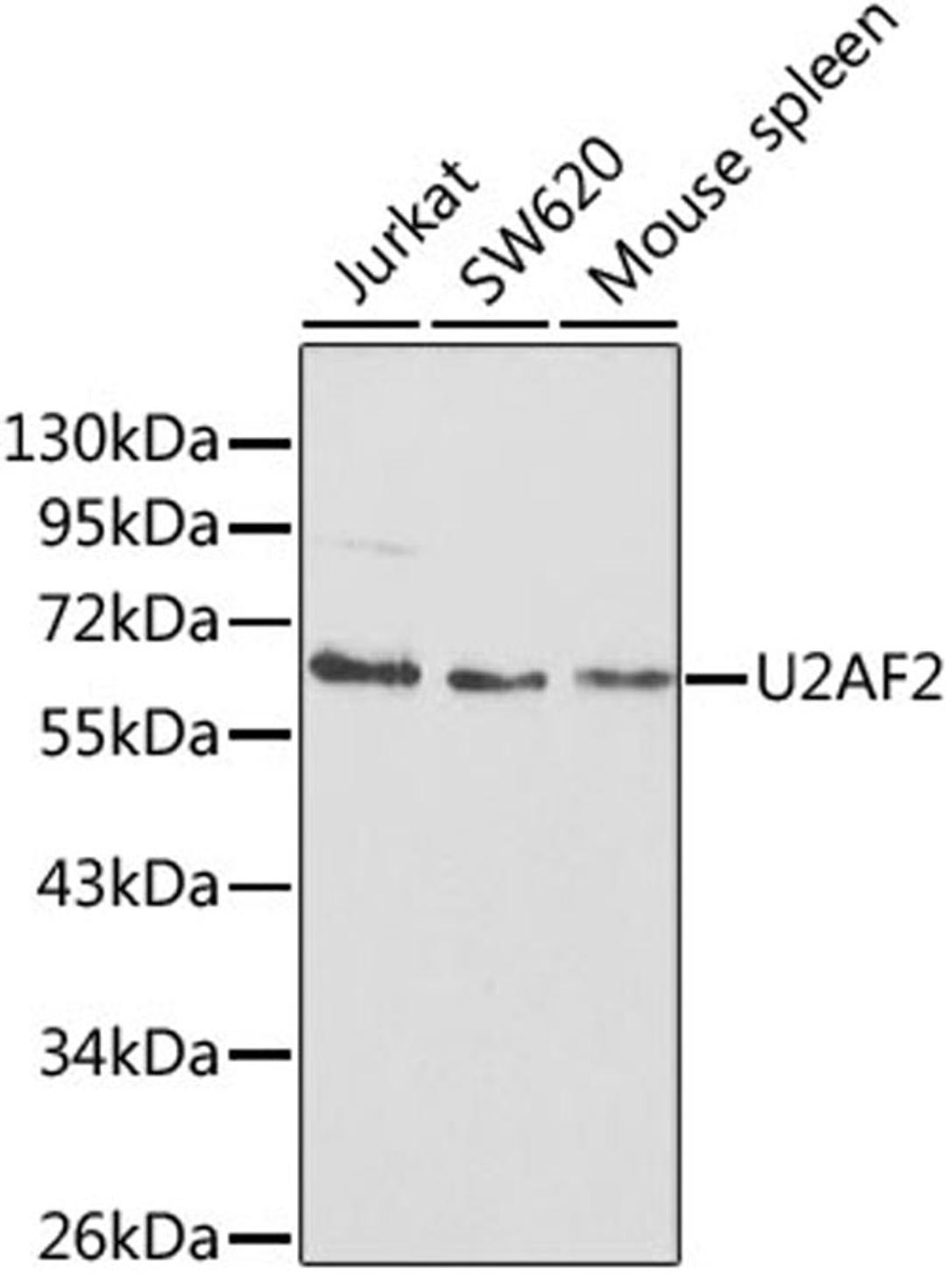 Western blot - U2AF2 antibody (A1936)