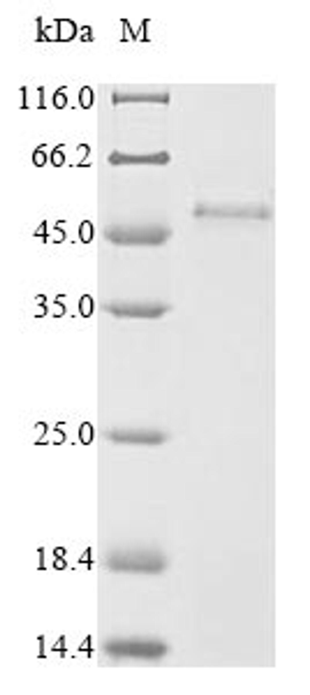 (Tris-Glycine gel) Discontinuous SDS-PAGE (reduced) with 5% enrichment gel and 15% separation gel.