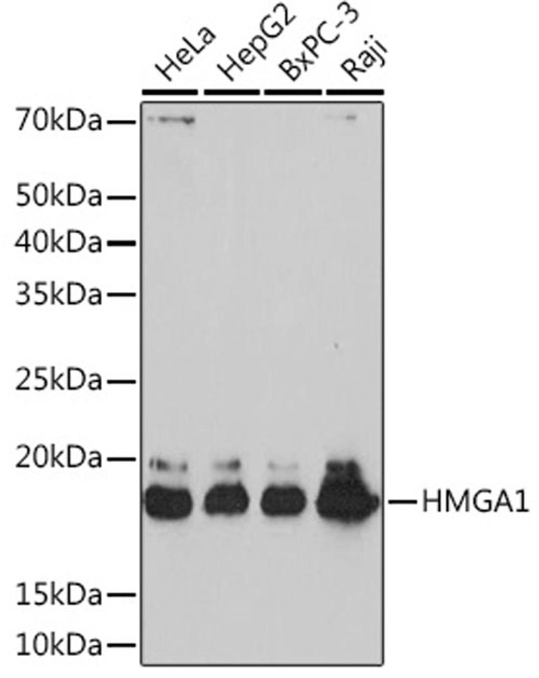 Western blot - HMGA1 Rabbit mAb (A4343)