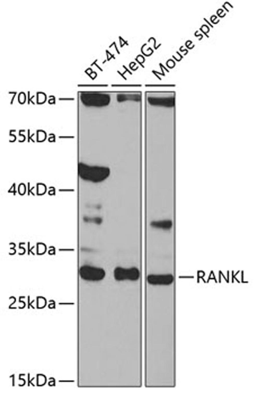 Western blot - RANKL antibody (A2550)