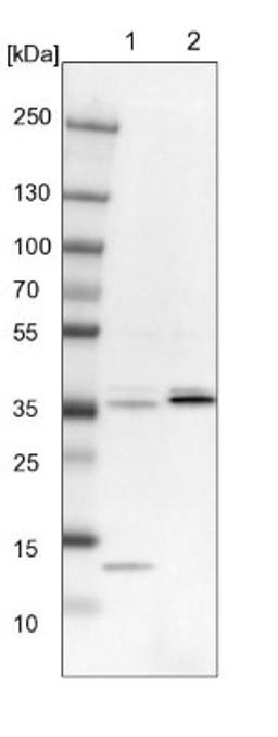 Western Blot: Sulfatase Modifying Factor 1/SUMF1 Antibody [NBP1-83905] - Lane 1: NIH-3T3 cell lysate (Mouse embryonic fibroblast cells)<br/>Lane 2: NBT-II cell lysate (Rat Wistar bladder tumour cells)