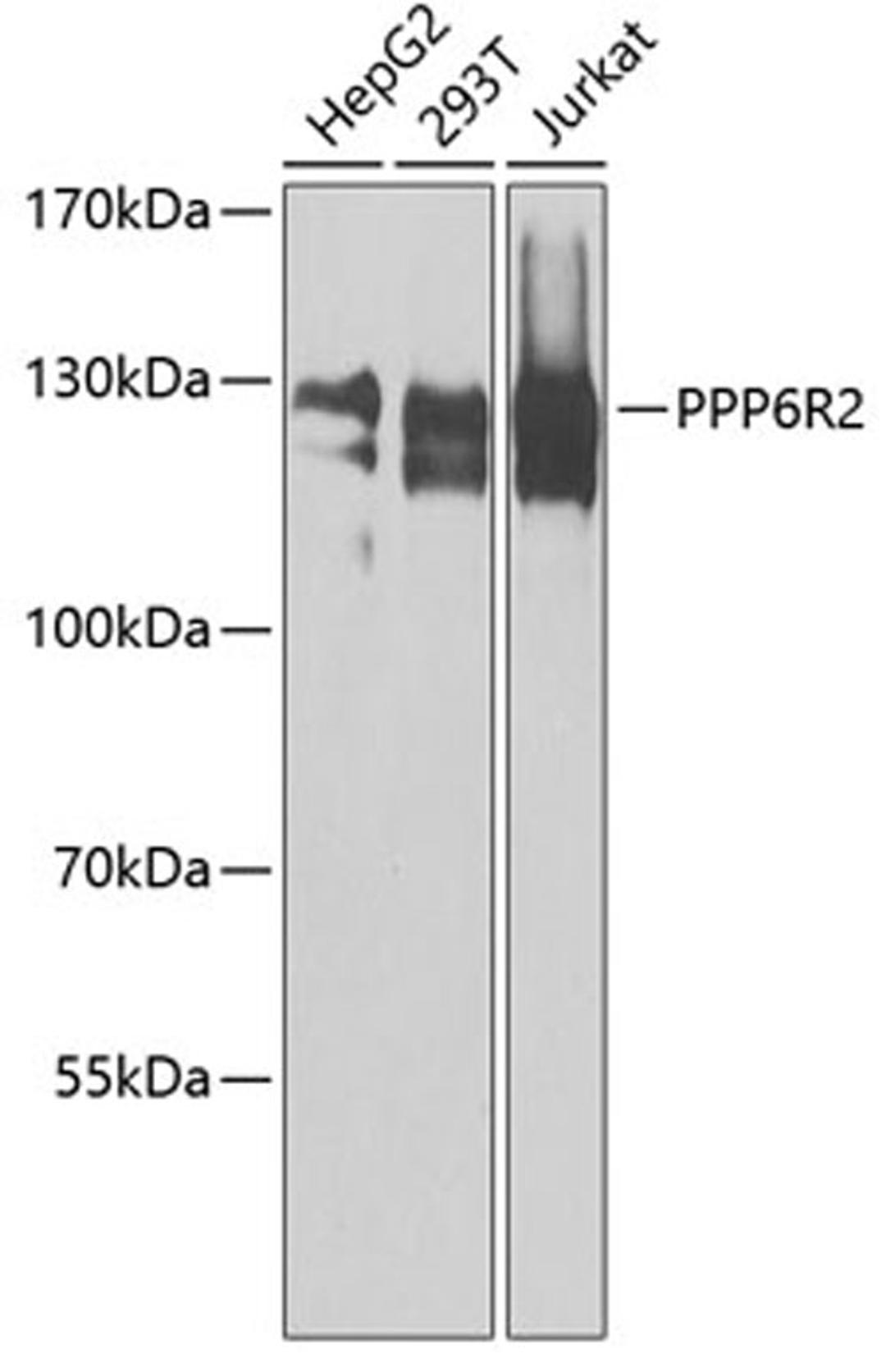 Western blot - PPP6R2 antibody (A8359)