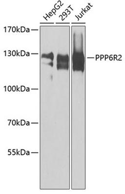 Western blot - PPP6R2 antibody (A8359)