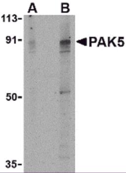 Western blot analysis of PAK5 in T24 lysate with PAK5 antibody at (A) 2 and (B) 4 &#956;g/mL.