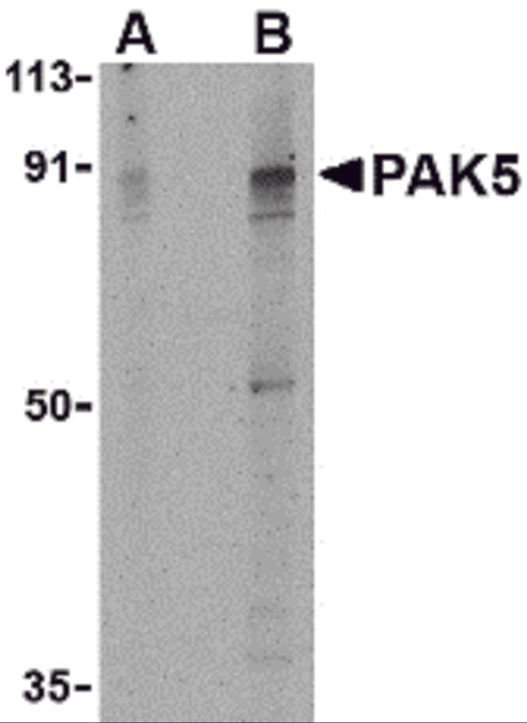 Western blot analysis of PAK5 in T24 lysate with PAK5 antibody at (A) 2 and (B) 4 μg/mL.