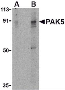 Western blot analysis of PAK5 in T24 lysate with PAK5 antibody at (A) 2 and (B) 4 μg/mL.
