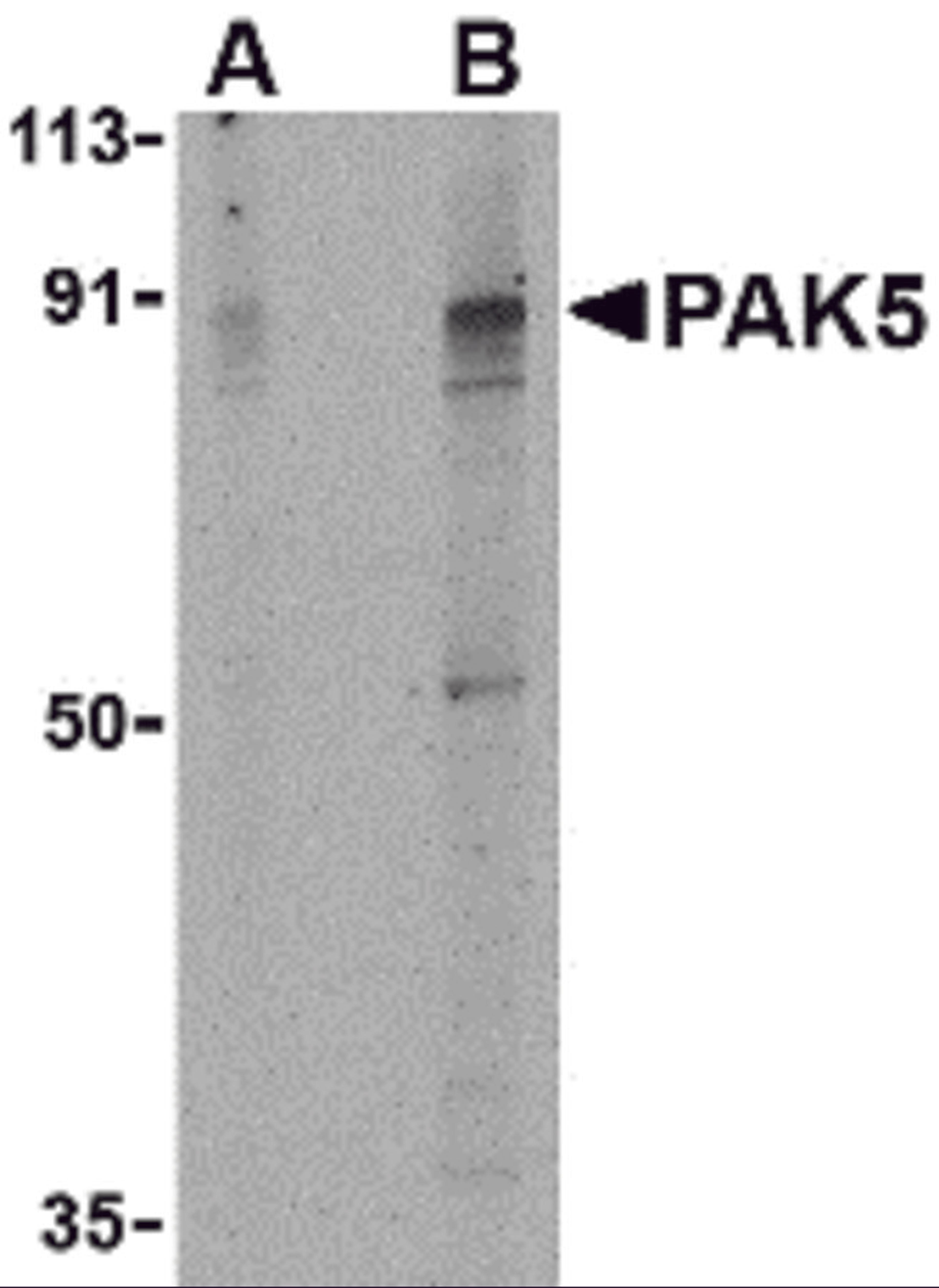 Western blot analysis of PAK5 in T24 lysate with PAK5 antibody at (A) 2 and (B) 4 μg/mL.