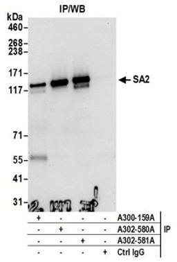 Detection of human SA2 by western blot of immunoprecipitates.