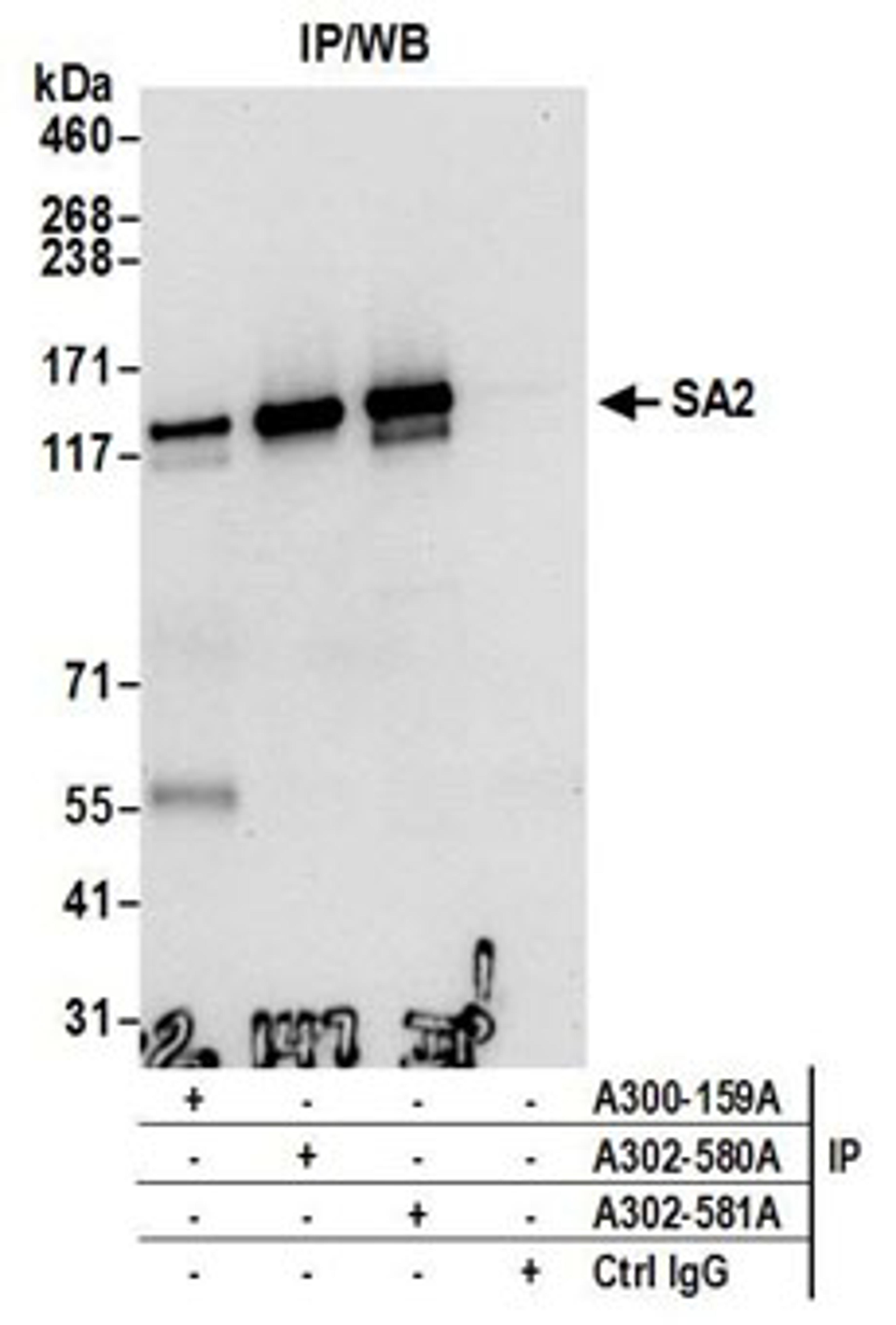 Detection of human SA2 by western blot of immunoprecipitates.