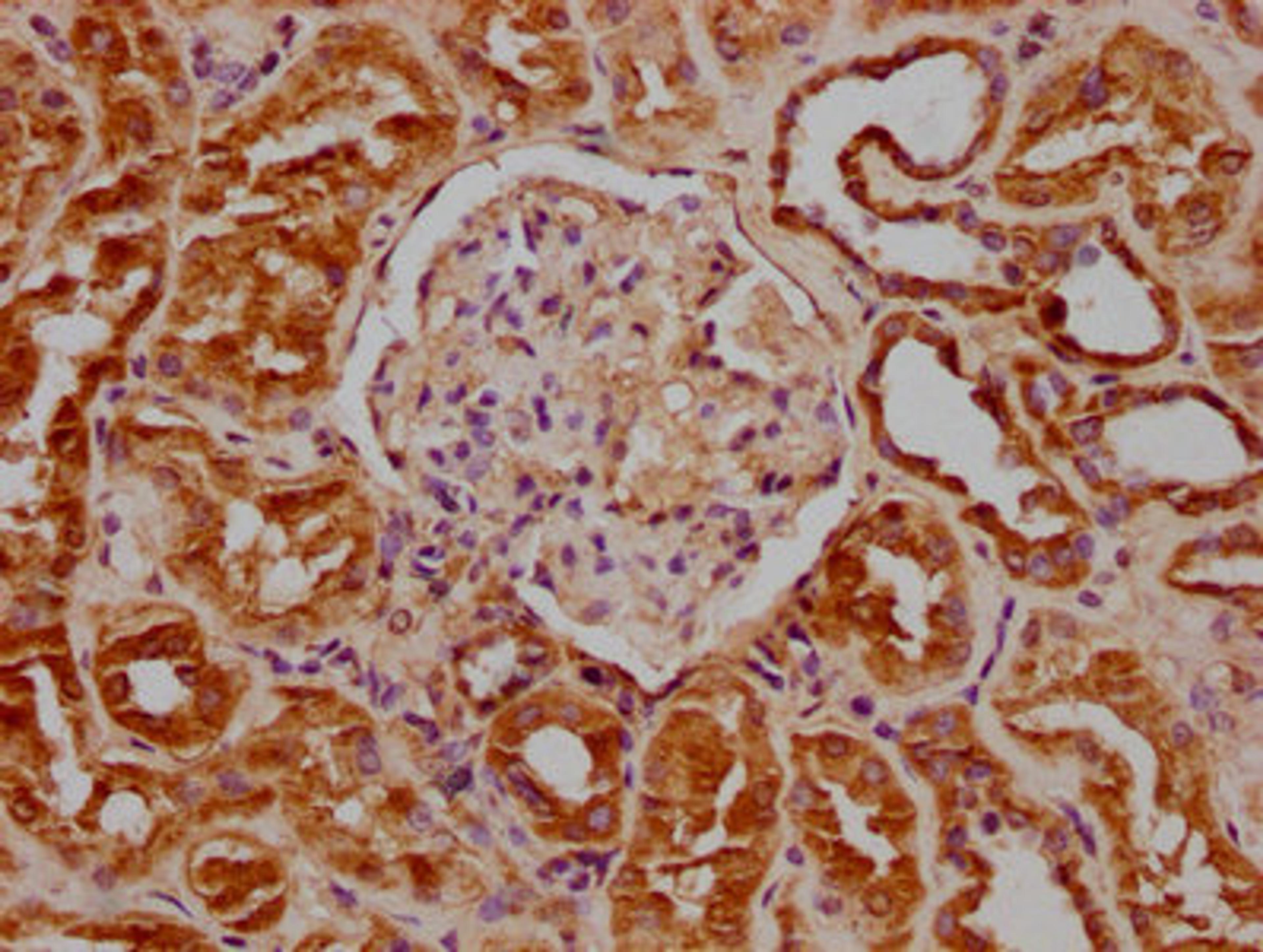 IHC image of CSB-PA009614OA01HU diluted at 1:100 and staining in paraffin-embedded human kidney tissue performed on a Leica BondTM system. After dewaxing and hydration, antigen retrieval was mediated by high pressure in a citrate buffer (pH 6.0). Section was blocked with 10% normal goat serum 30min at RT. Then primary antibody (1% BSA) was incubated at 4°C overnight. The primary is detected by a biotinylated secondary antibody and visualized using an HRP conjugated SP system.