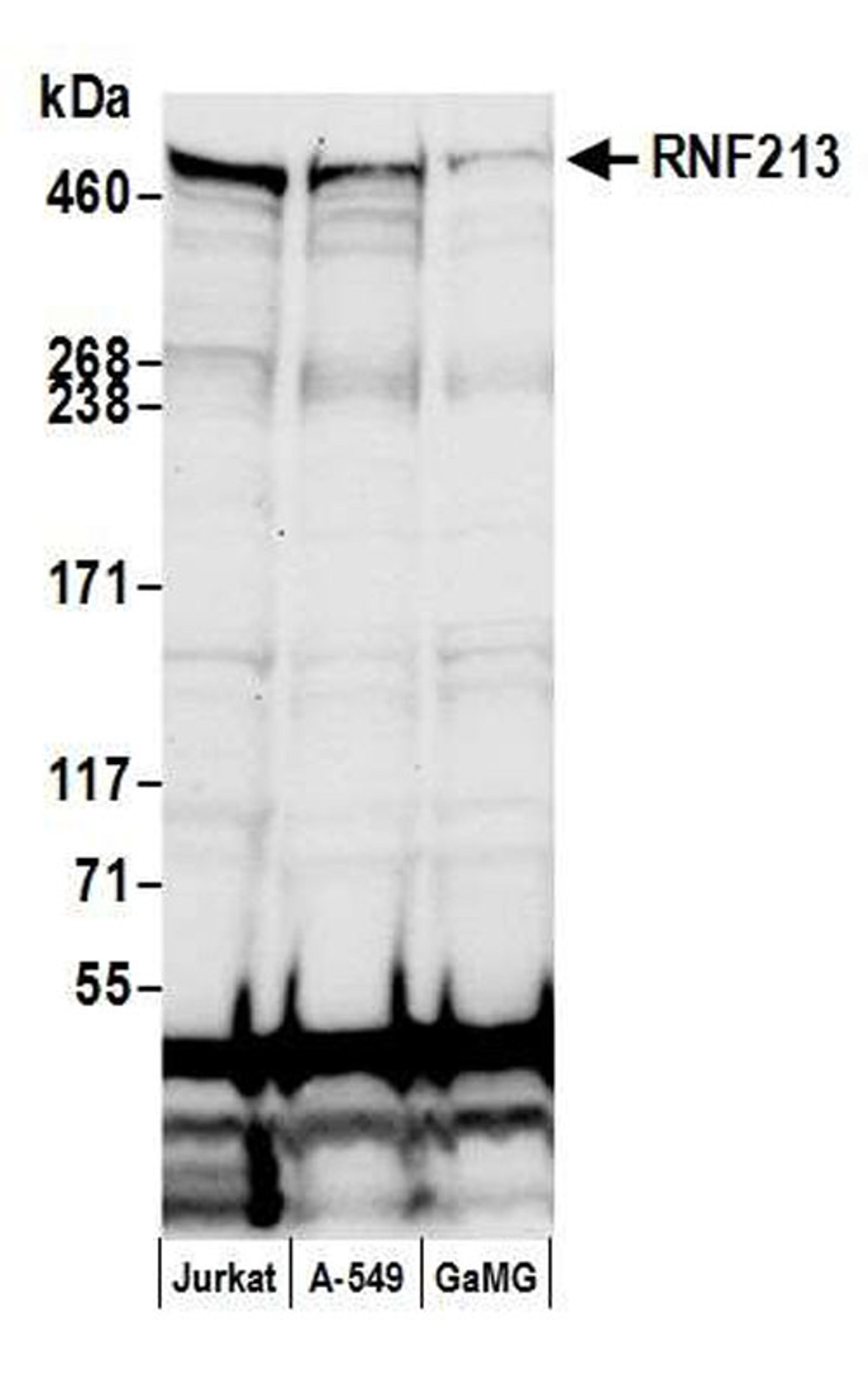 Detection of human RNF213 by WB.