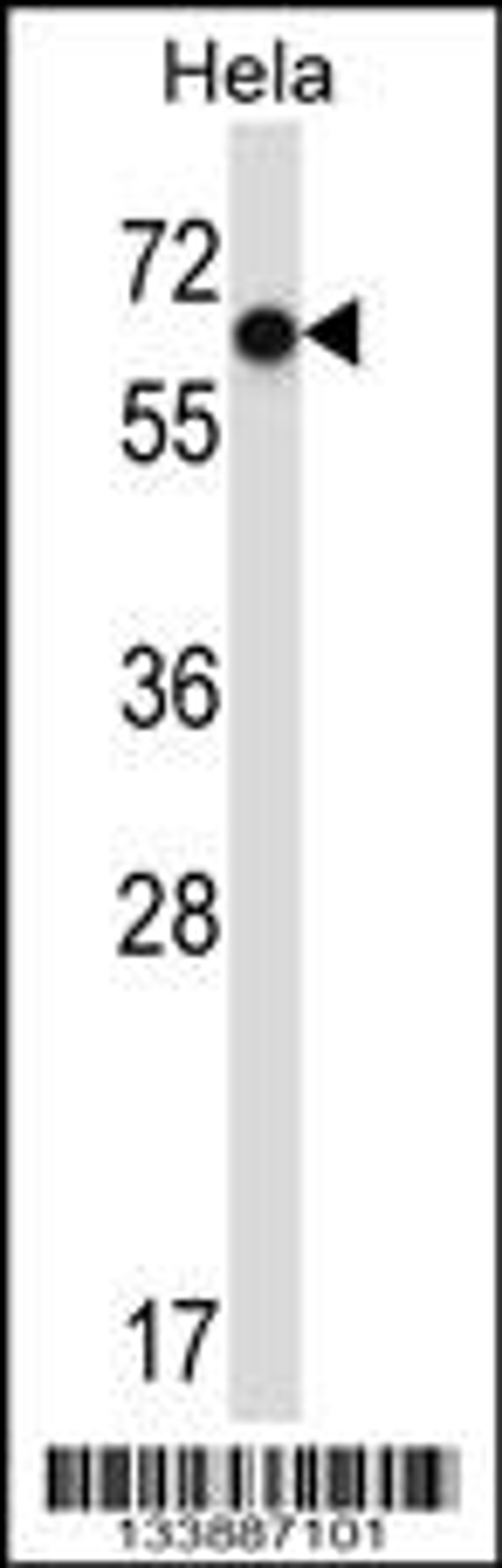 Western blot analysis in Hela cell line lysates (35ug/lane).