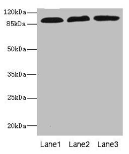 Western blot. All lanes: CD97 antibody at 3.11ug/ml. Lane 1: HL60 whole cell lysate. Lane 2: HepG2 whole cell lysate. Lane 3: Jurkat whole cell lysate. Secondary. Goat polyclonal to rabbit IgG at 1/10000 dilution. Predicted band size: 92, 82, 87 kDa. Observed band size: 92 kDa.