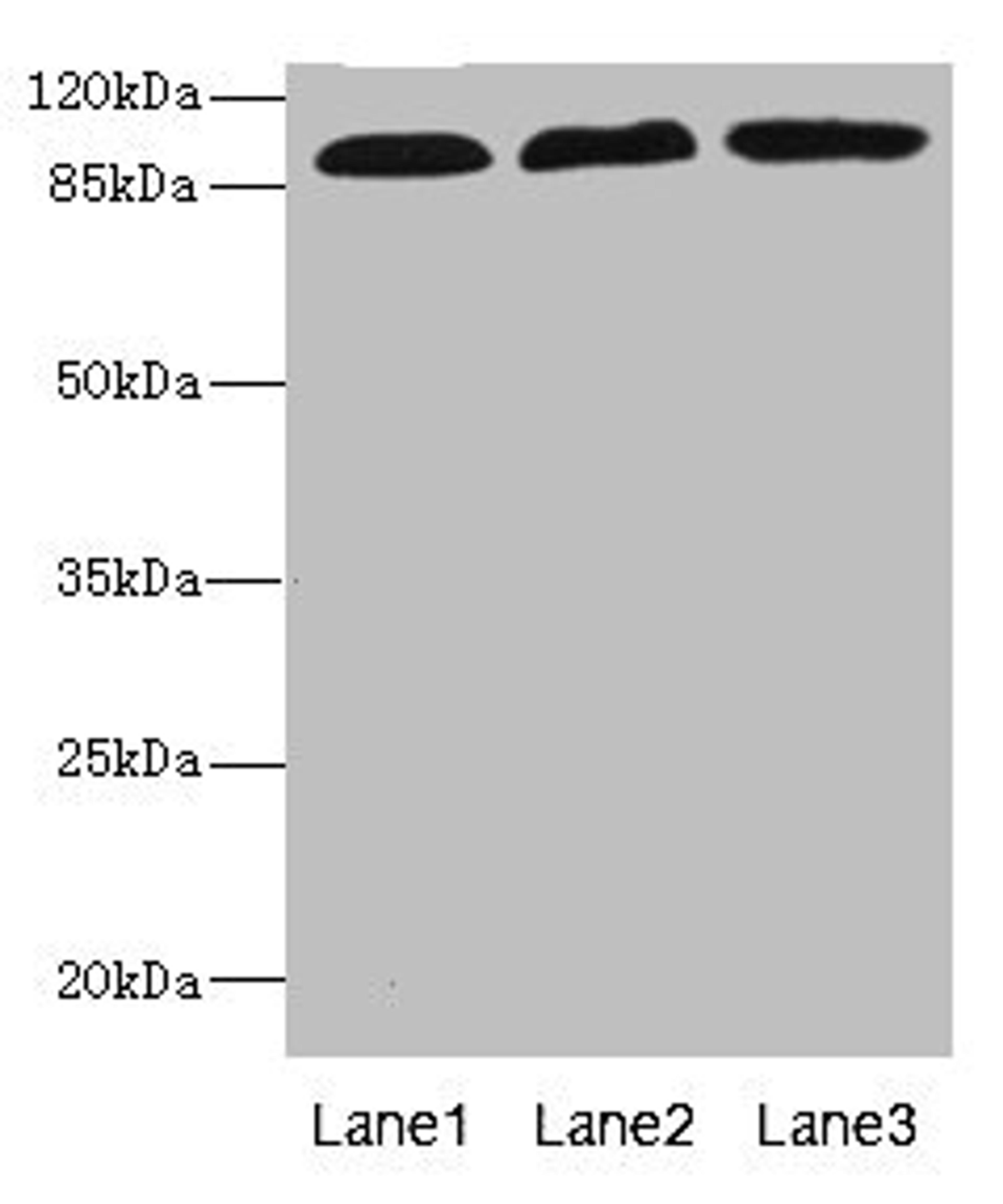 Western blot. All lanes: CD97 antibody at 3.11ug/ml. Lane 1: HL60 whole cell lysate. Lane 2: HepG2 whole cell lysate. Lane 3: Jurkat whole cell lysate. Secondary. Goat polyclonal to rabbit IgG at 1/10000 dilution. Predicted band size: 92, 82, 87 kDa. Observed band size: 92 kDa.
