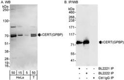 Detection of human CERT(GPBP) by western blot and immunoprecipitation.