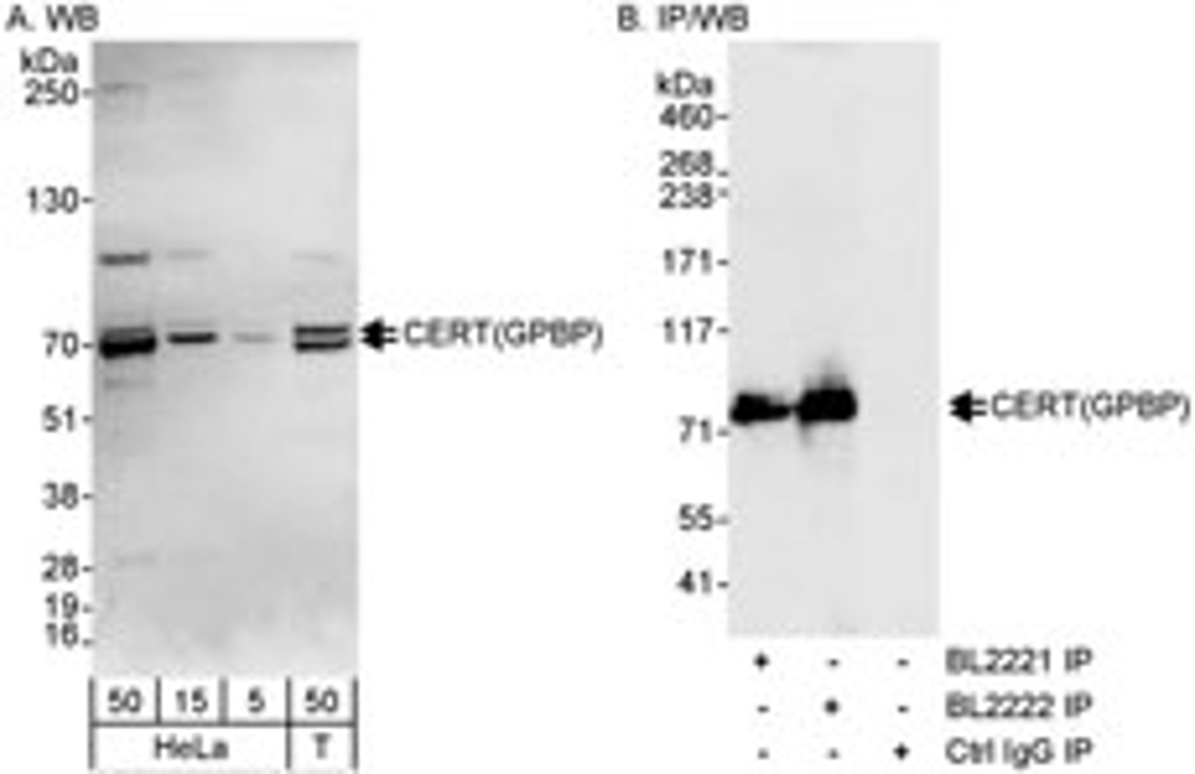 Detection of human CERT(GPBP) by western blot and immunoprecipitation.