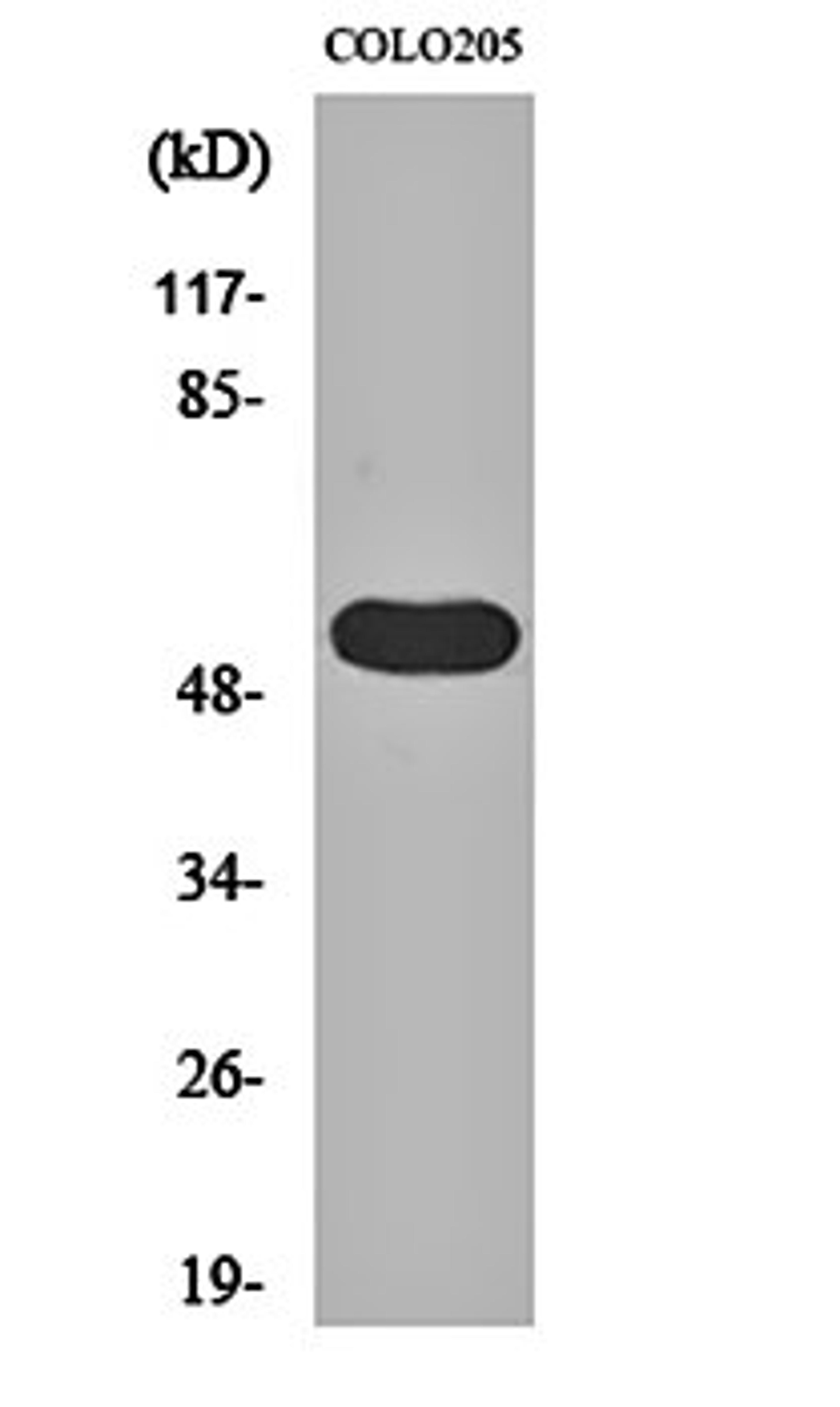 Western blot analysis of COLO205 cell lysates using LPD lipase antibody