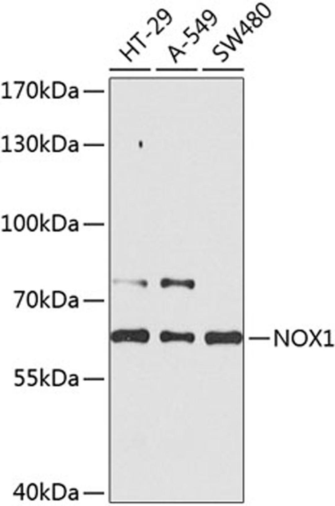 Western blot - NOX1 antibody (A8527)