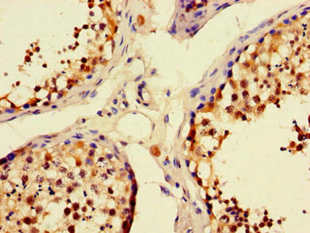 Immunohistochemistry of paraffin-embedded human testis tissue using CSB-PA843314LA01HU at dilution of 1:100