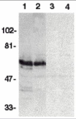 Western blot analysis of SODD in HeLa (1,3) and THP-1 (2,4) whole cell lysates in the absence (1,2) or presence (3,4) of blocking peptide (Catalog no. 2143P) with SODD antibody at 1:500 dilution.