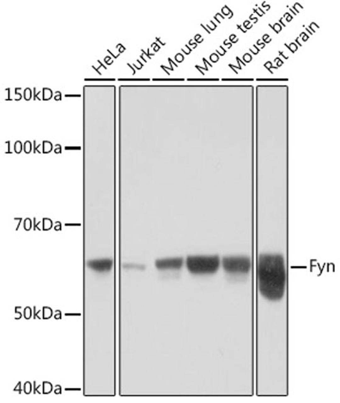 Western blot - Fyn Rabbit mAb (A9165)