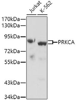 Western blot - PRKCA antibody (A0267)