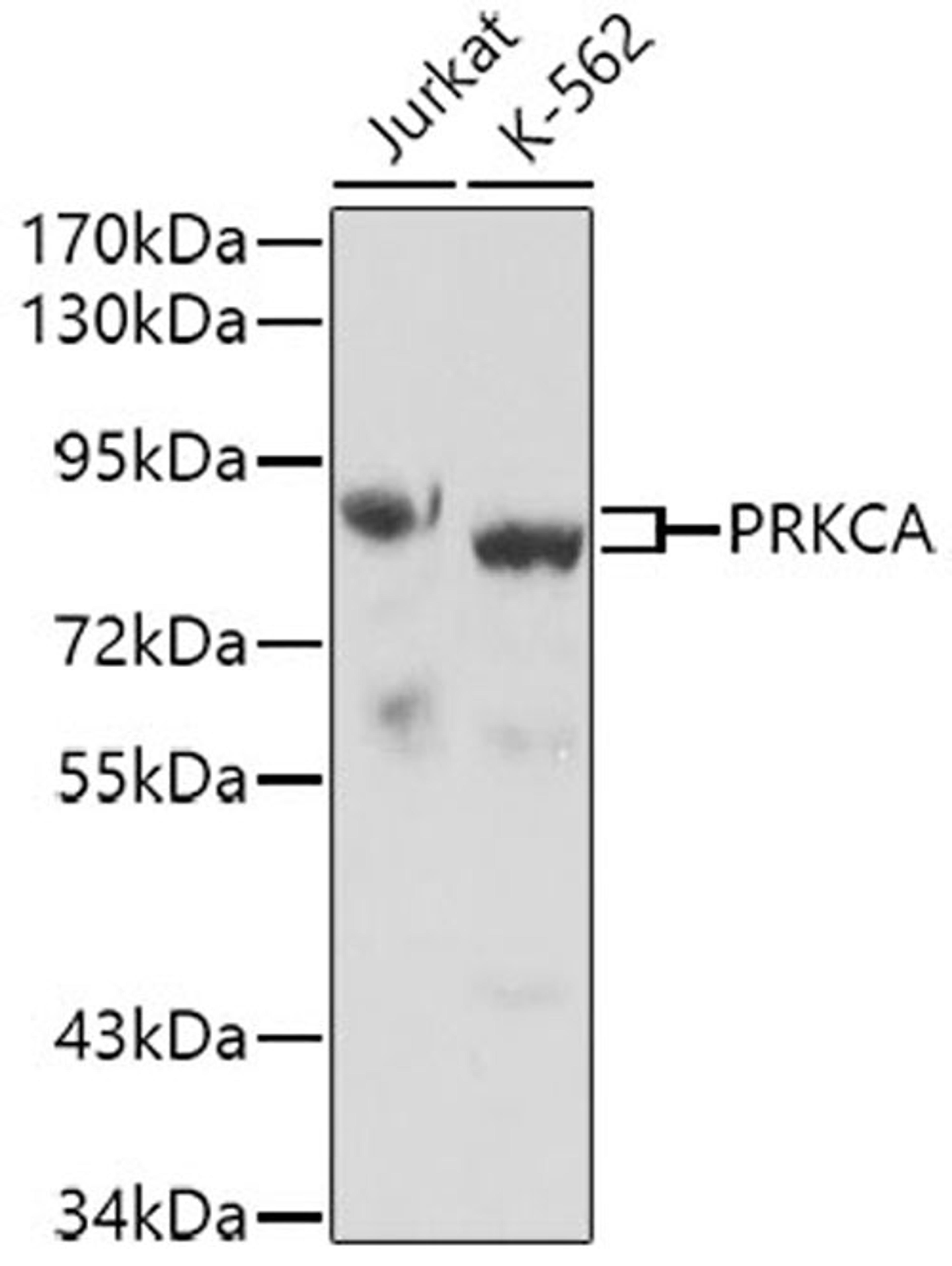 Western blot - PRKCA antibody (A0267)