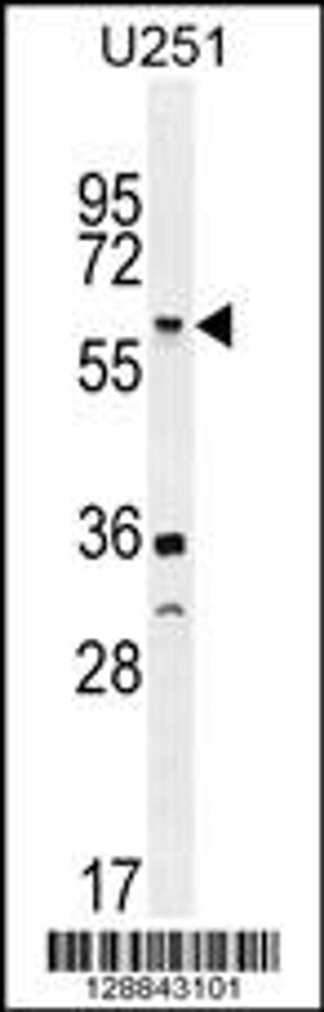 Western blot analysis in U251 cell line lysates (35ug/lane).