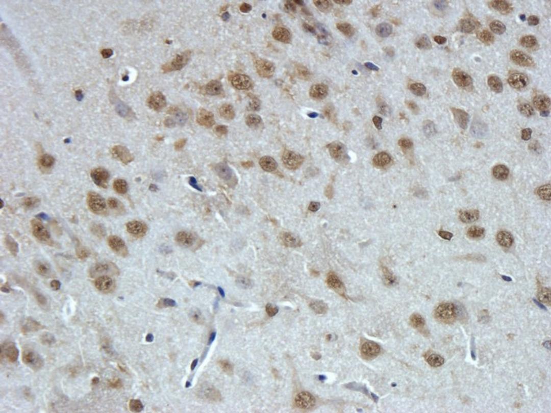 IHC-P image of rat brain tissue using GPR1  Antibody antibody (5 ug/ml)