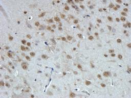 IHC-P image of rat brain tissue using GPR1  Antibody antibody (5 ug/ml)