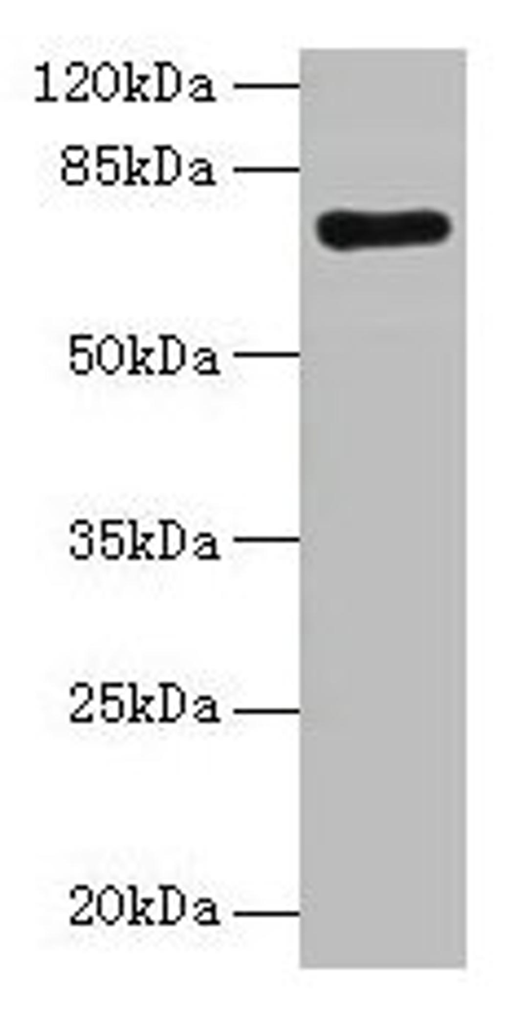Western blot. All lanes: KAT7 antibody at 2µg/ml + Rat brain tissue. Secondary. Goat polyclonal to rabbit IgG at 1/10000 dilution. Predicted band size: 71, 59, 52, 67, 56 kDa. Observed band size: 71 kDa