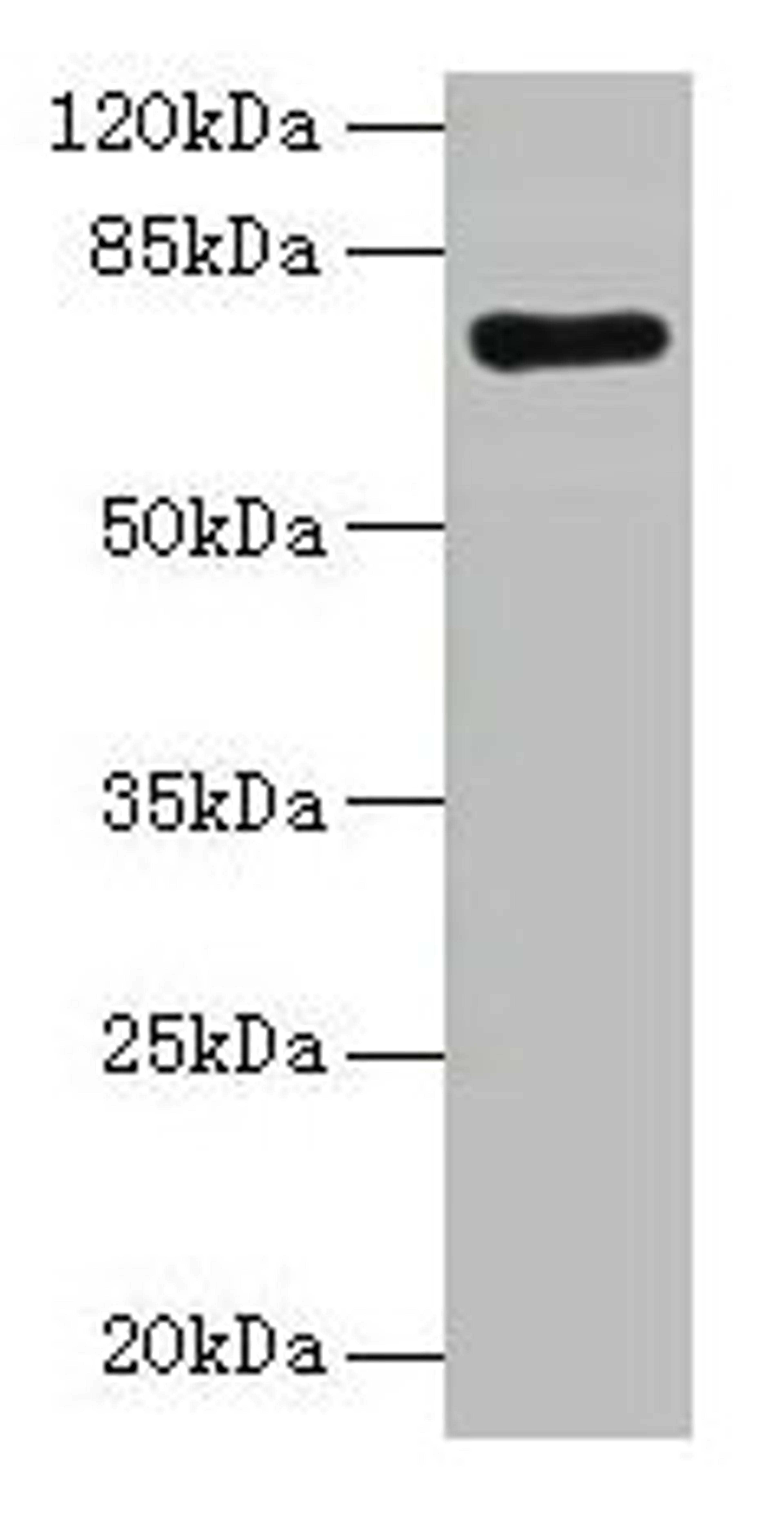 Western blot. All lanes: KAT7 antibody at 2µg/ml + Rat brain tissue. Secondary. Goat polyclonal to rabbit IgG at 1/10000 dilution. Predicted band size: 71, 59, 52, 67, 56 kDa. Observed band size: 71 kDa