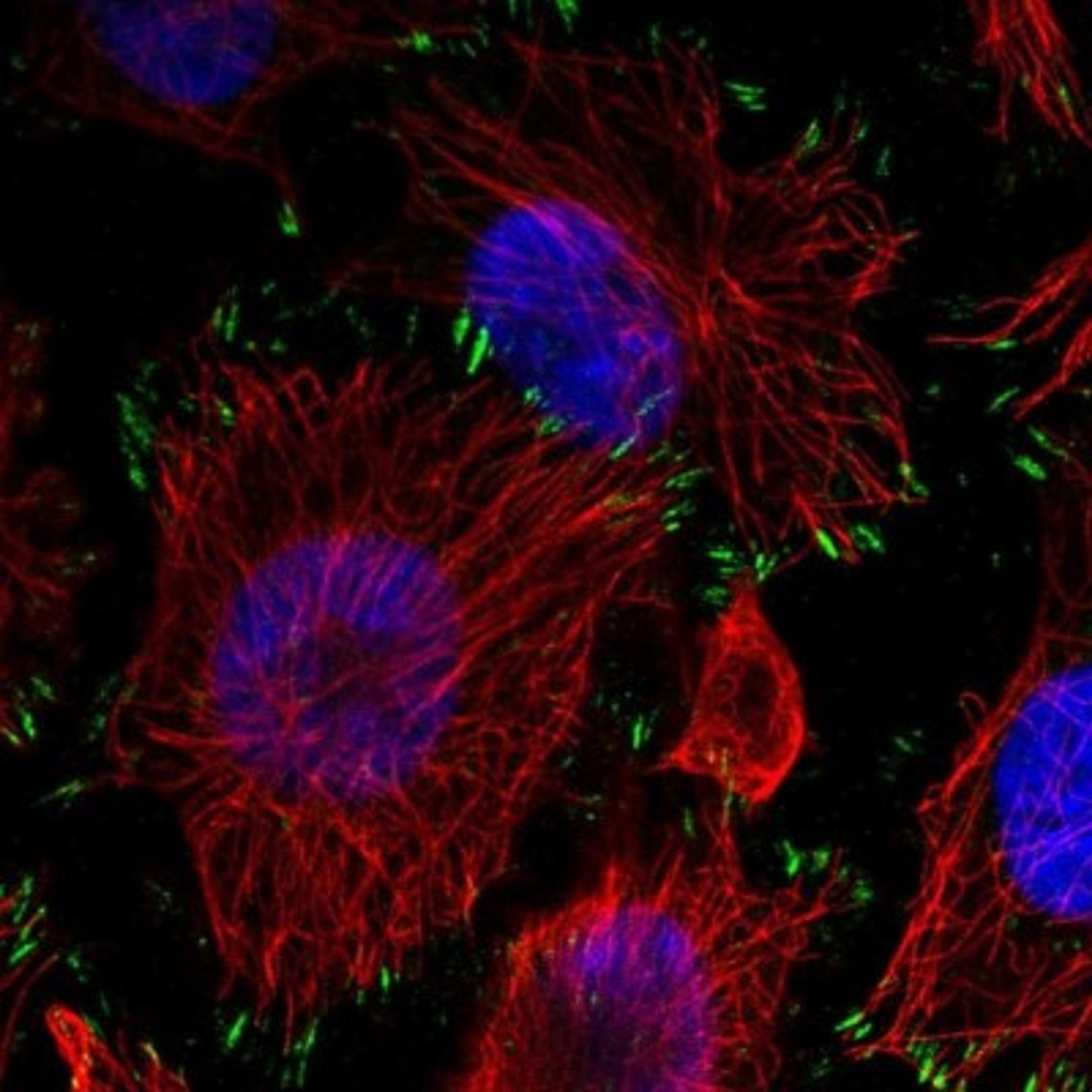 Immunocytochemistry/Immunofluorescence: DHTKD1 Antibody [NBP1-84087] - Staining of human cell line U-251 MG shows positivity in focal adhesions.