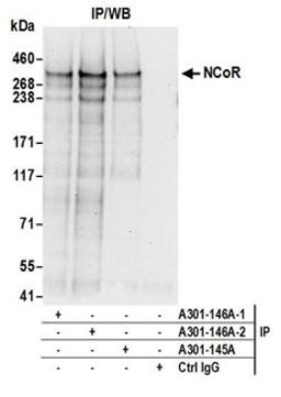 Detection of human NCoR by western blot of immunoprecipitates.