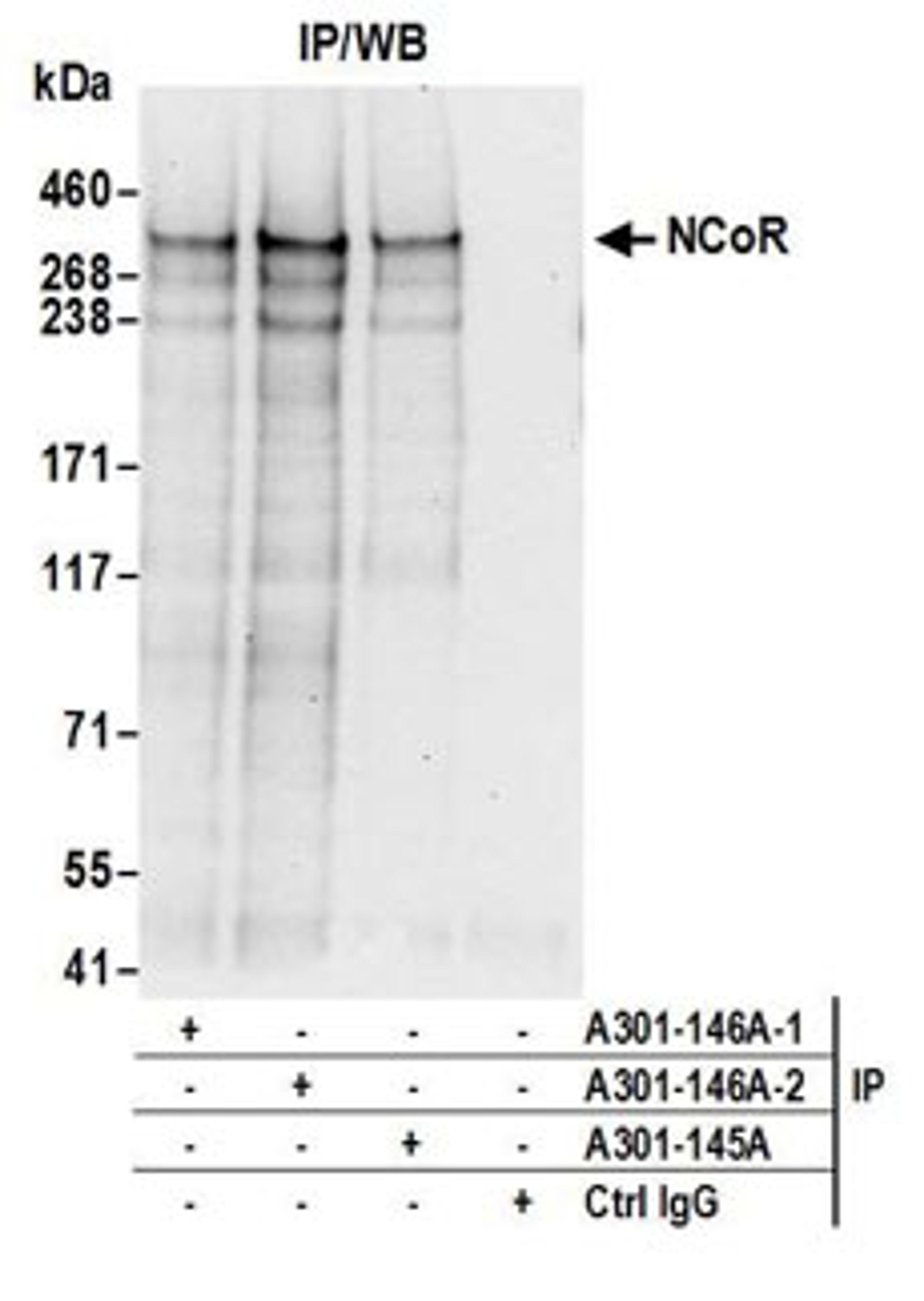 Detection of human NCoR by western blot of immunoprecipitates.