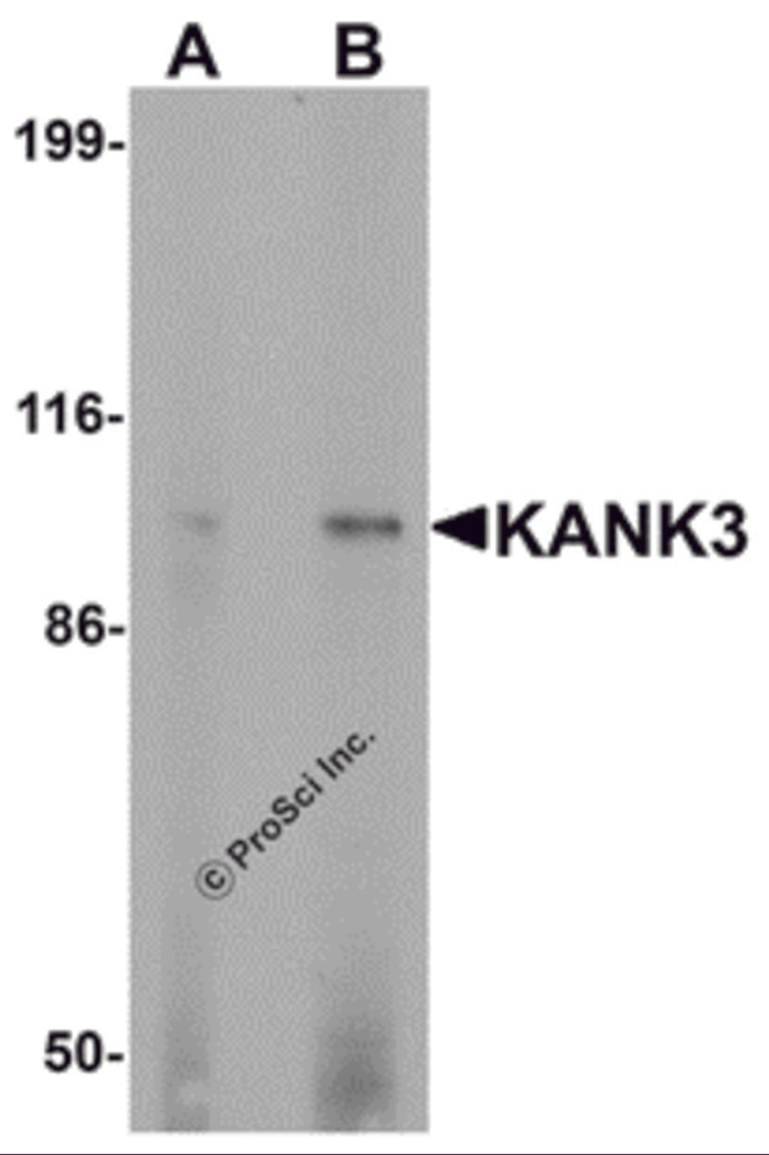 Western blot analysis of KANK3 in A431 cell lysate with KANK3 antibody at (A) 1 and (B) 2 μg/mL.