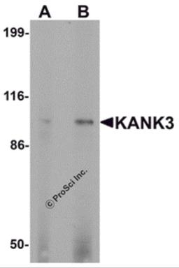 Western blot analysis of KANK3 in A431 cell lysate with KANK3 antibody at (A) 1 and (B) 2 μg/mL.