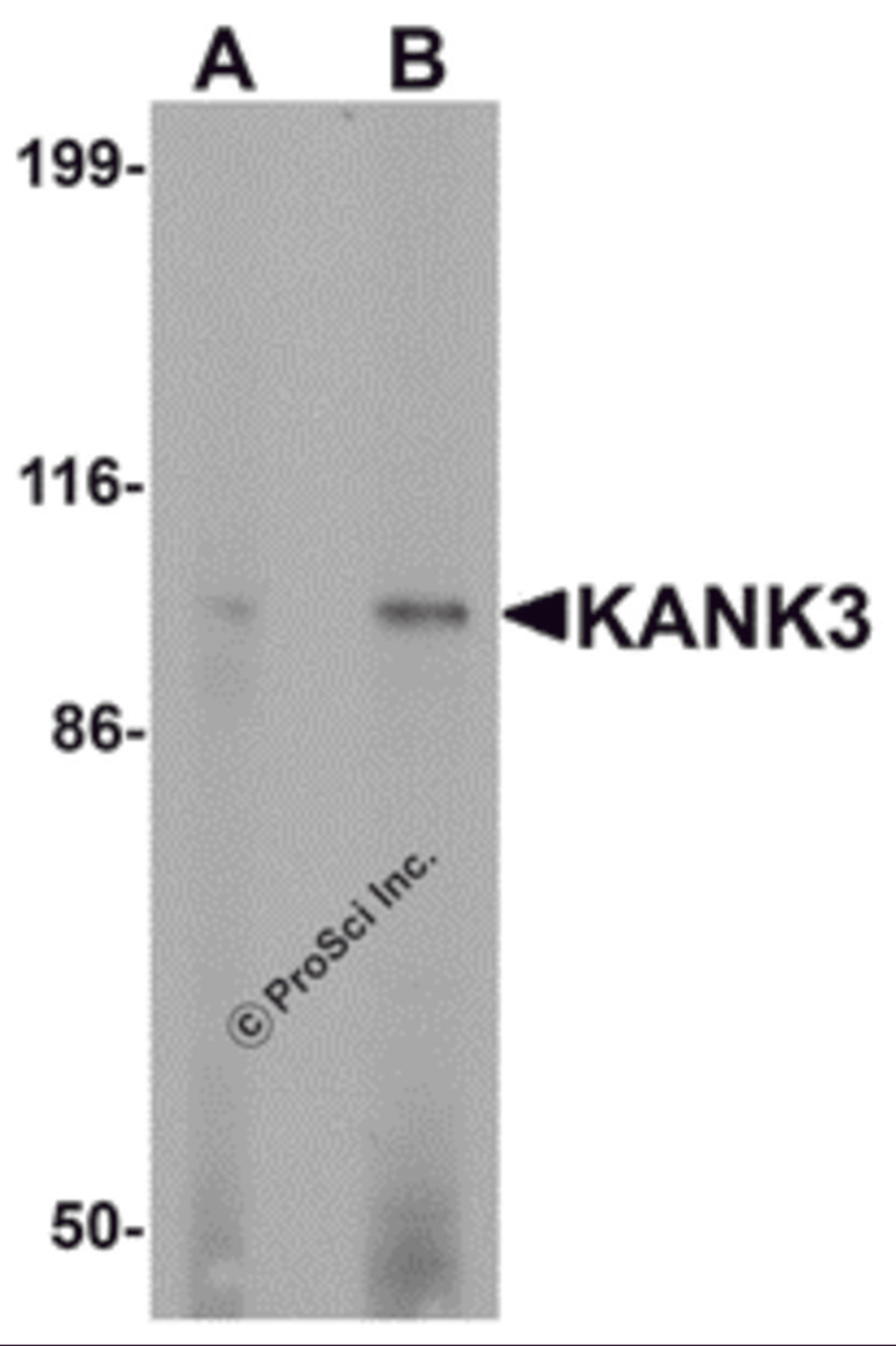 Western blot analysis of KANK3 in A431 cell lysate with KANK3 antibody at (A) 1 and (B) 2 μg/mL.