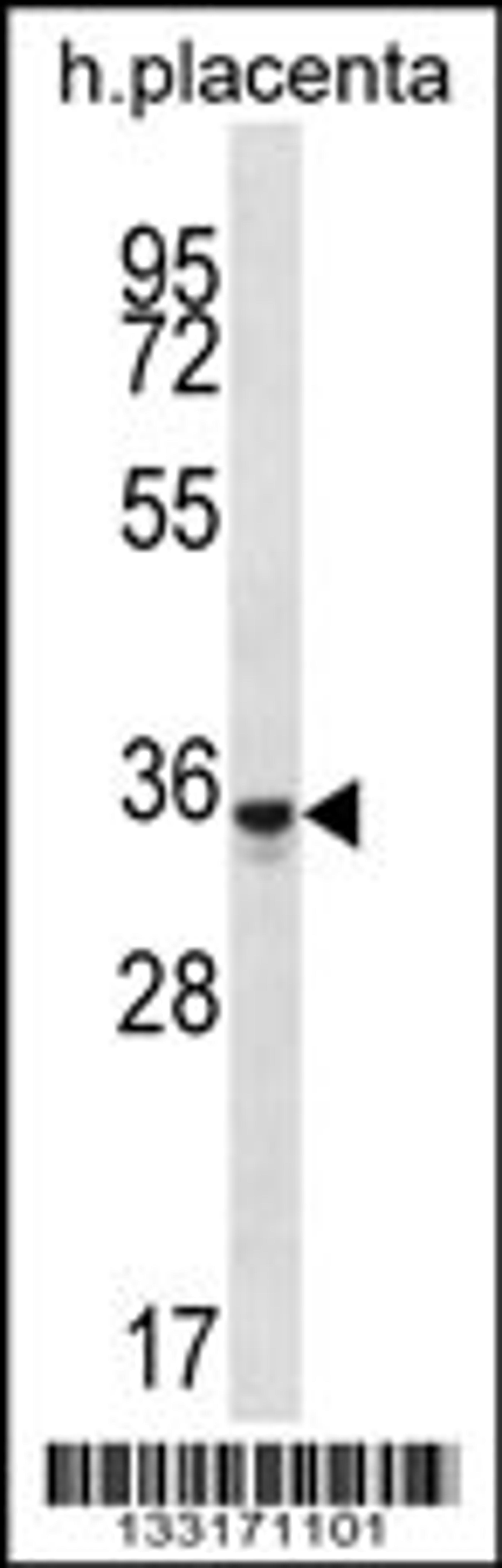 Western blot analysis in human placenta tissue lysates (35ug/lane).